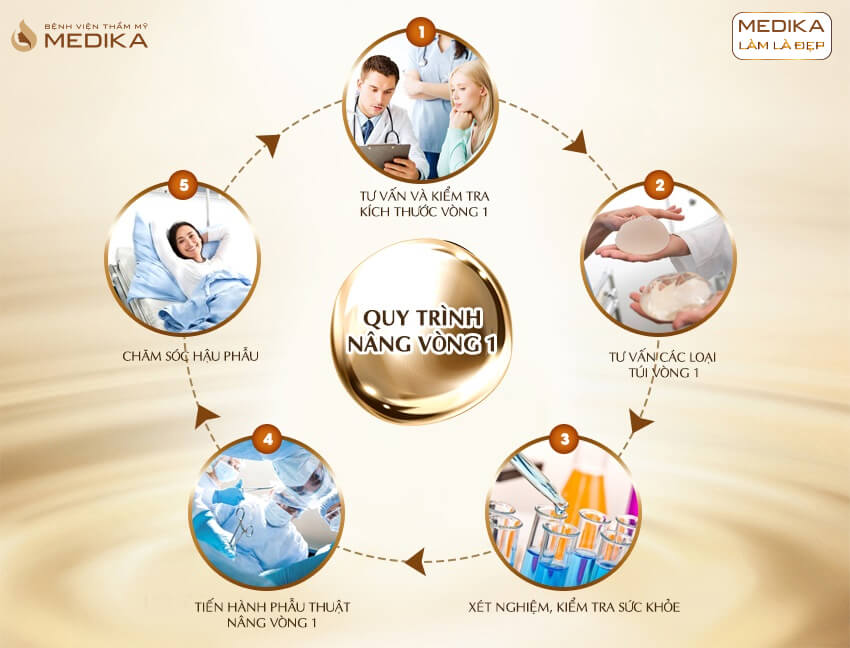 Quy trình phẫu thuật nâng vòng 1 Big Size ở bệnh viện thẩm mỹ MEDIKA