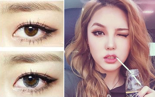 bấm mí mắt hàn quốc