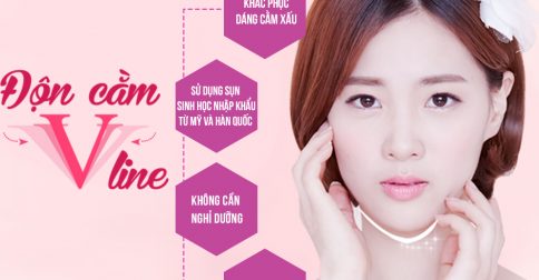 Phẫu thuật độn cằm V Line có vĩnh viễn không?