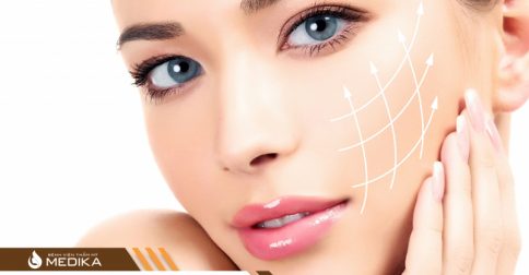 Hút chì, thải độc, sáng mịn da bằng công nghệ Spectra Carbon
