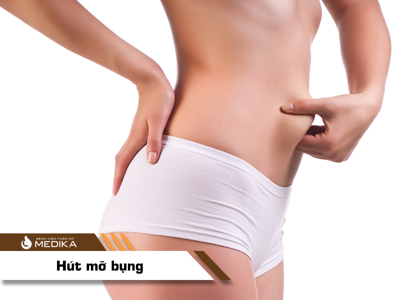 hút mỡ bụng