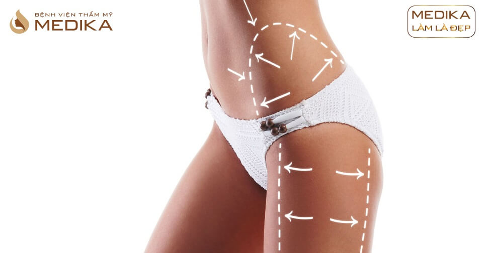 4-dieu-cam-ky-sau-khi-thuc-hien-hut-mo-khong-phau-thuat 4 điều cấm kỵ sau khi thực hiện hút mỡ không phẫu thuật