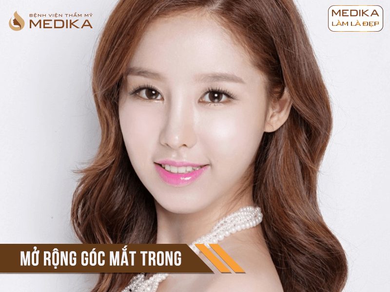 mo-rong-goc-mat-trong-nhung-luu-y-quan-trong Mở rộng góc mắt trong những lưu ý quan trọng