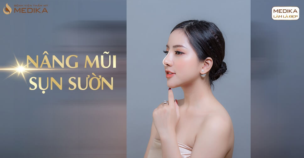 Định giá nâng mũi sụn sườn theo công nghệ thẩm mỹ nano Nang-mui-sun-suon-medika-vn-thumbnails
