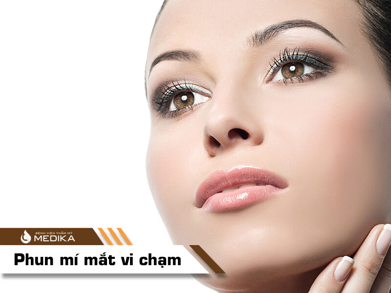 Phun mí mắt vi chạm tại Bệnh viện thẩm mỹ MEDIKA