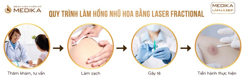 Quy trình Làm hồng nhũ hoa bằng Laser Fractional ở Bệnh viện thẩm mỹ MEDIKA