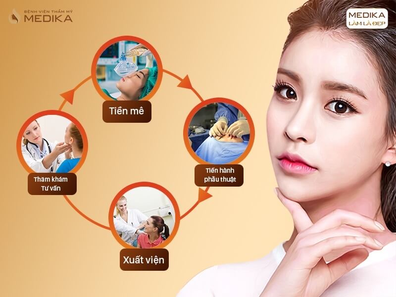 Quy trình thực hiện nâng mũi sụn sườn - MEDIKA.vn