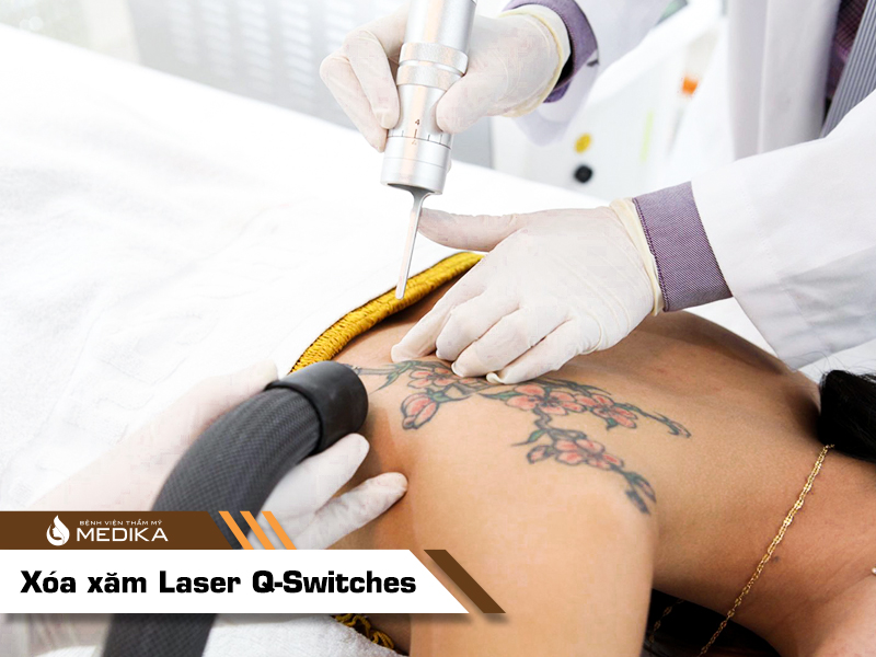 xóa xăm Laser Q-Switches tại Bệnh viện thẩm mỹ MEDIKA