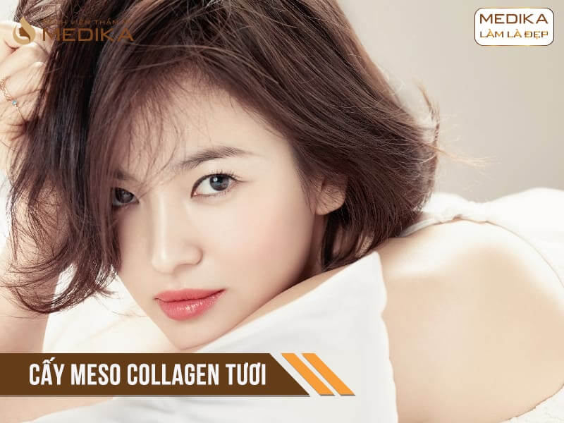 Cấy Collagen tươi ở Bệnh viện thẩm mỹ MEDIKA.vn