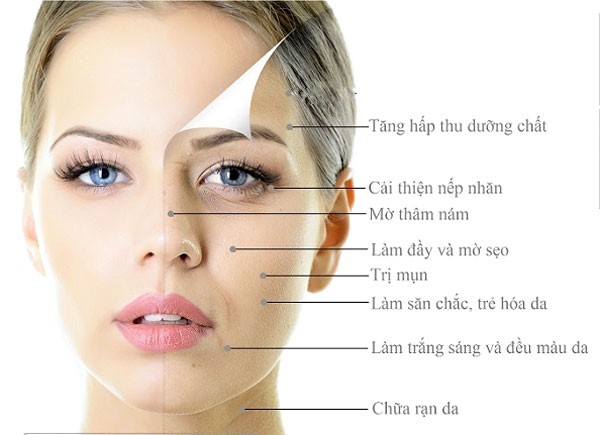 lăn kim tế bào gốc