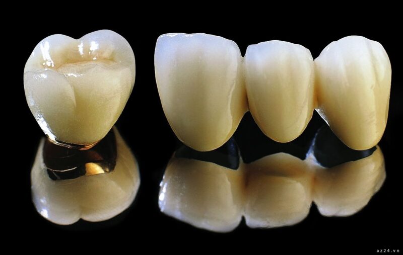 Bọc răng sứ Titan có hại không?