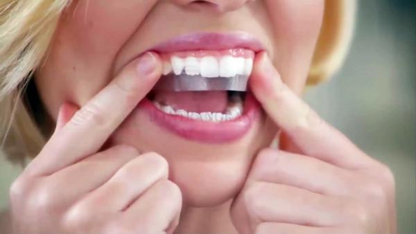 Tẩy trắng răng bằng miếng dán