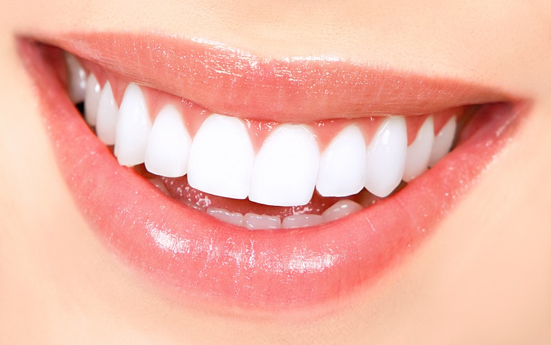 Bọc răng sứ toàn hàm có nguy hiểm không?