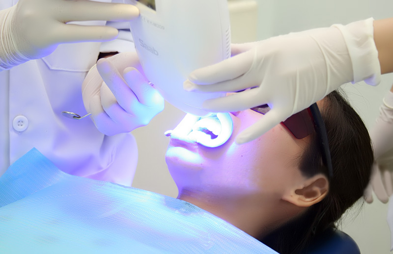 Tẩy trắng răng bằng laser là công nghệ tẩy trắng răng hiện đại