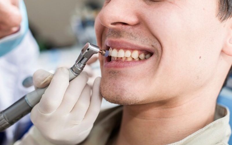 Lấy cao răng liên tục có gây hại hay không?