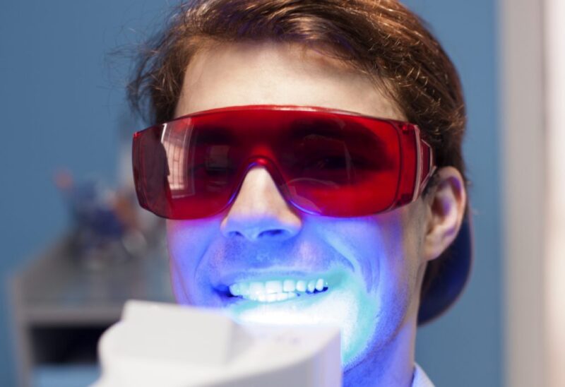 Tẩy trắng răng bằng Laser ở đâu tốt nhất?