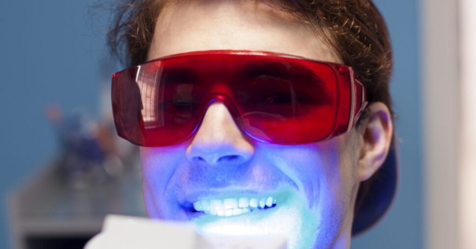 Tẩy trắng răng bằng Laser ở đâu hiệu quả tốt