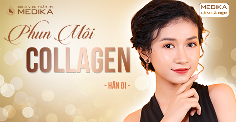 Phun Môi Collagen