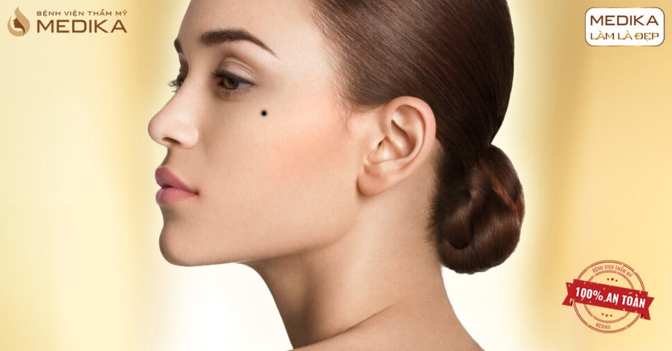 Cách chăm sóc da sau khi xóa nốt ruồi bằng Laser để tránh sẹo