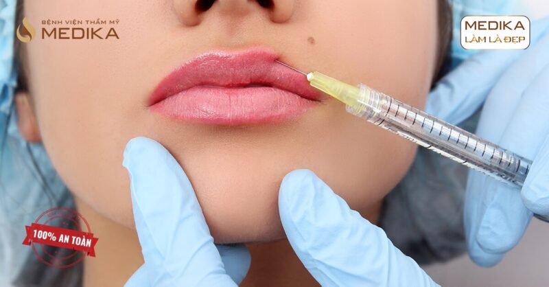 Tiêm Filler môi bị bầm tím và cách giải quyết tại bệnh viện thẩm mỹ MEDIKA