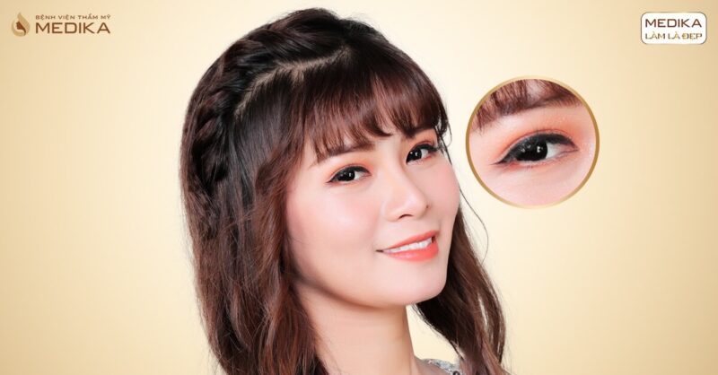 Thời gian bấm mí Hàn Quốc giữ được bao lâu? - MEDIKA.vn