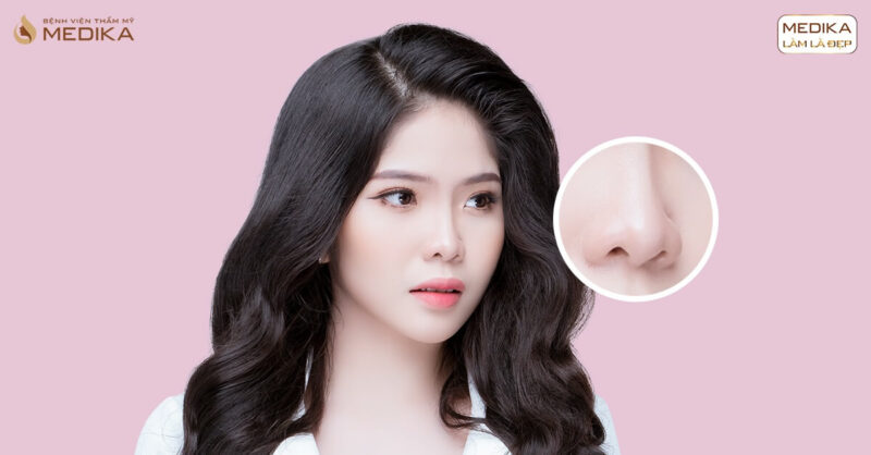 Thu gọn cánh mũi bao lâu thì hồi phục? - Bệnh viện thẩm mỹ MEDIKA