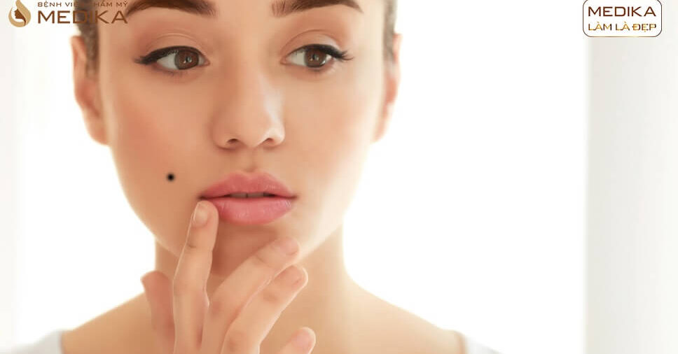 Chia sẻ từ chuyên gia về phương pháp xóa nốt ruồi bằng laser