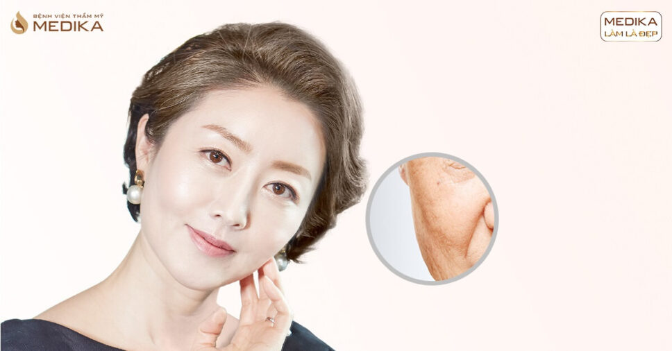 Đừng vội căng da bằng chỉ khi chưa biết điều này