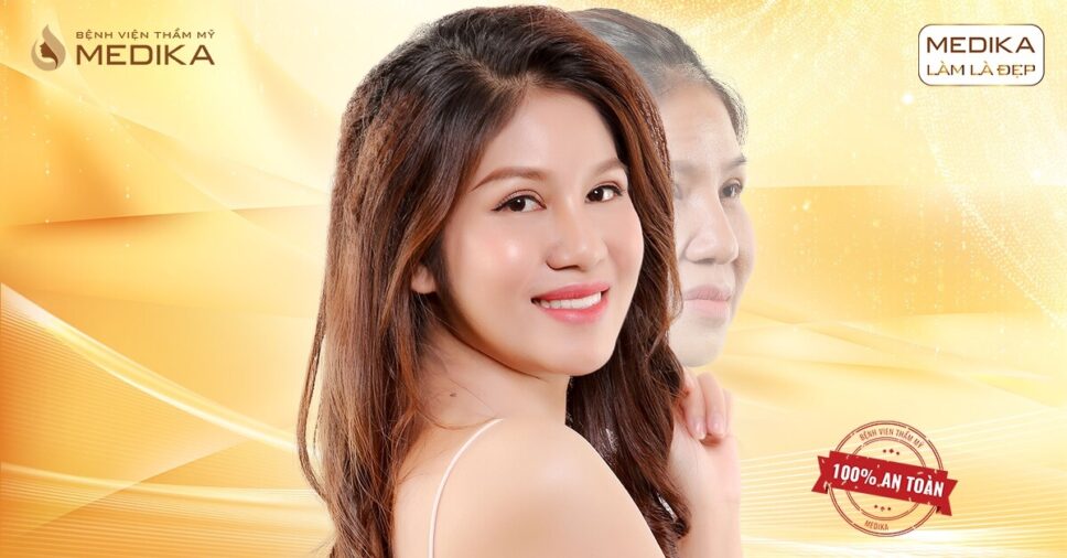 Tại sao căng da bằng chỉ lại được ưa chuộng trên thị trường?