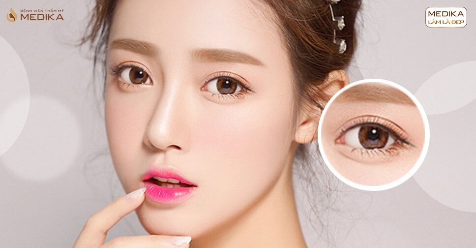 Mắt đẹp mơ màng với phương pháp cắt mí mắt Hàn Quốc - MEDIKA.vn