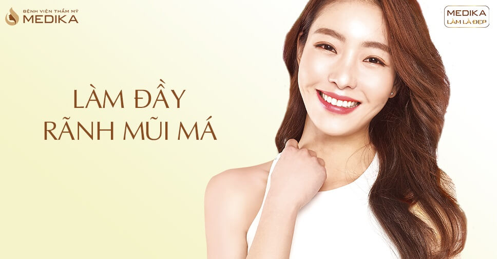 Làm đầy rãnh mũi và má - Bệnh viện thẩm mỹ MEDIKA