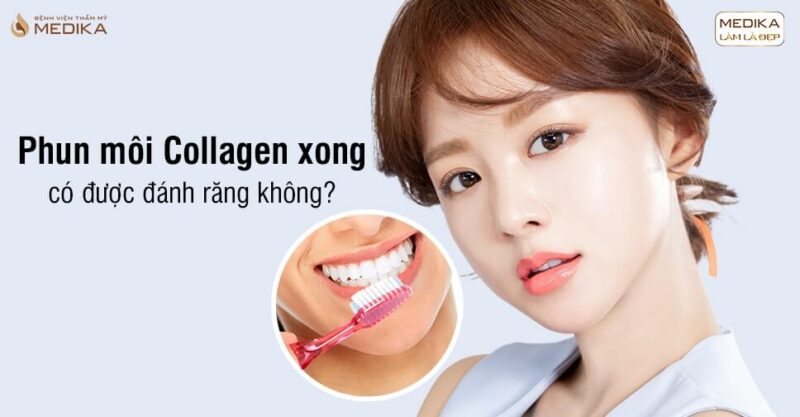 Phun môi Collagen xong có được đánh răng không? - Bệnh viện thẩm mỹ MEDIKA