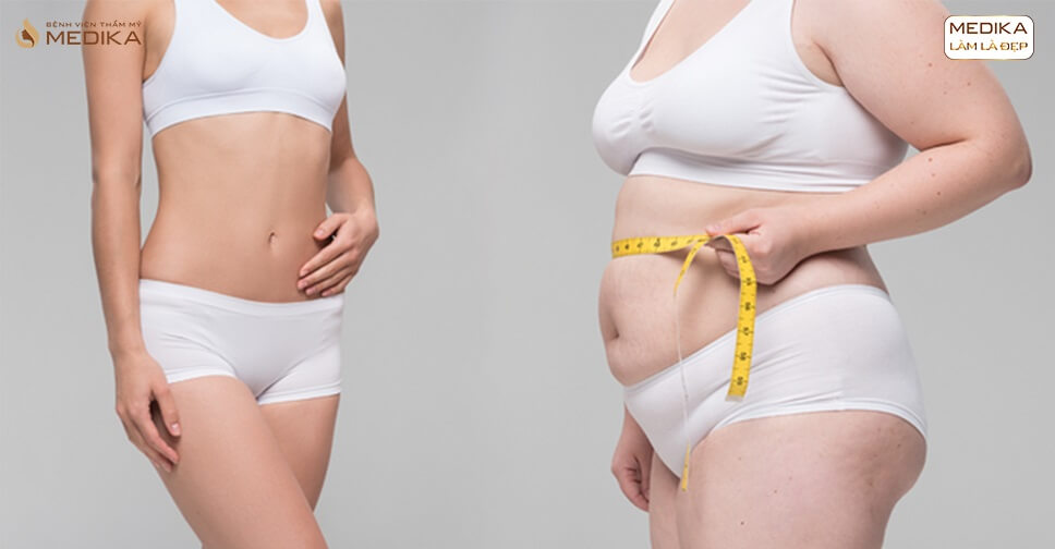 hut-mo-bung-1-nam-truoc-nhung-bi-tai-mo-phai-lam-sao Hút mỡ bụng 1 năm trước nhưng bị tái mỡ phải làm sao?