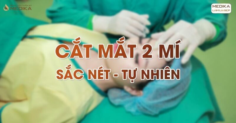 Một số triệu chứng sau cắt mắt 2 mí và cách khắc phục