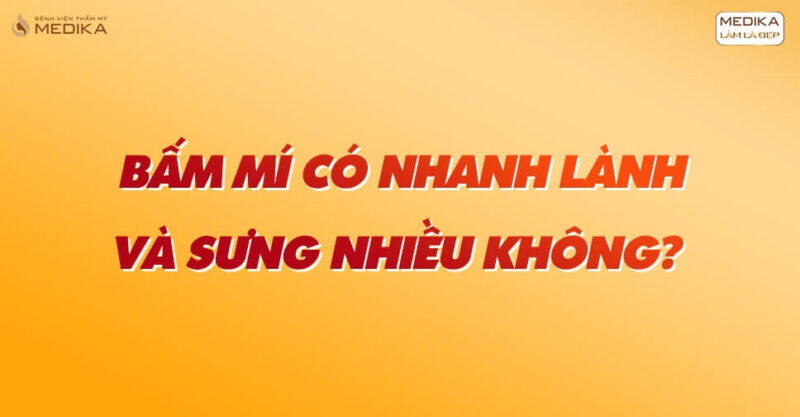 Bấm mí có nhanh lành và sưng nhiều lắm không?