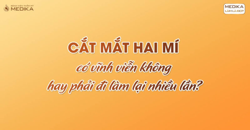 Cắt mắt hai mí có vĩnh viễn không hay phải đi làm lại nhiều lần?