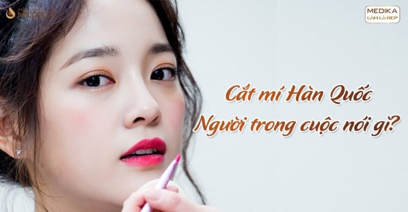 Cắt mí Hàn Quốc - Người trong cuộc nói gì?