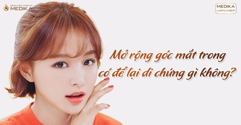 Mở rộng góc mắt trong có để lại di chứng gì không?