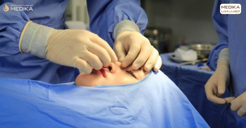 Phẫu thuật nâng mũi đẹp tưởng khó nhưng cực kì đơn giản - Bệnh viện thẩm mỹ MEDIKA