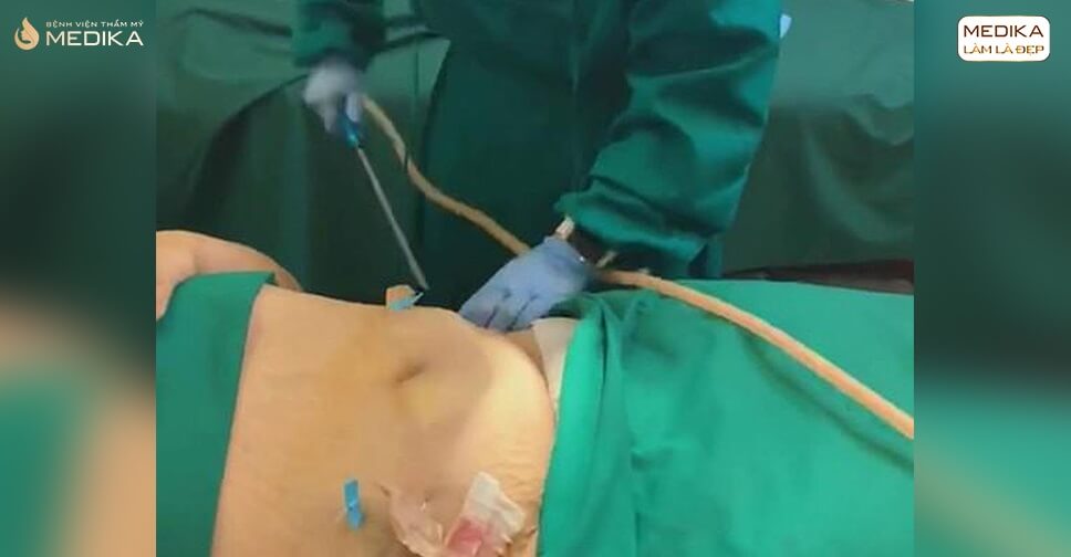 mo-duoi-da-mo-noi-tang-hieu-nhu-the-nao-cho-dung