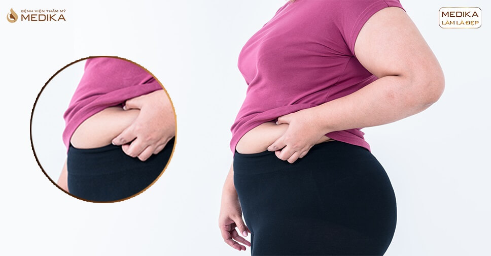 khac-phuc-loi-lom-sau-hut-mo-bung Khắc phục lồi lõm sau hút mỡ bụng