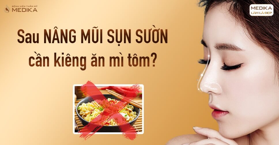 Những tác hại khôn lường vì ăn mì tôm sau nâng mũi sụn sườn - Bệnh viện thẩm mỹ MEDIKA