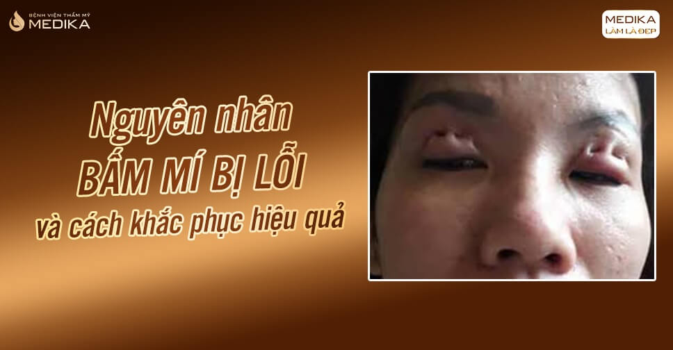 Bấm mí nguyên nhân bị lỗi và cách khắc phục hiệu quả