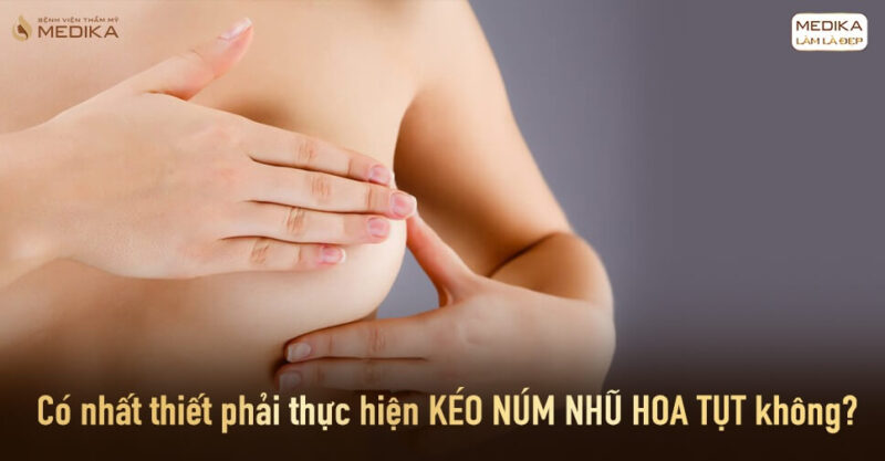 Kéo núm nhũ hoa tụt có nhất thiết phải thực hiện ?