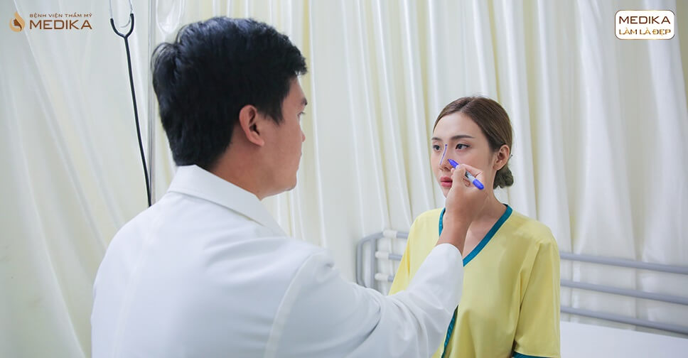 Nâng mũi sụn sườn - Thông tin cần thiết cho các tín đồ làm đẹp - Bệnh viện thẩm mỹ MEDIKA