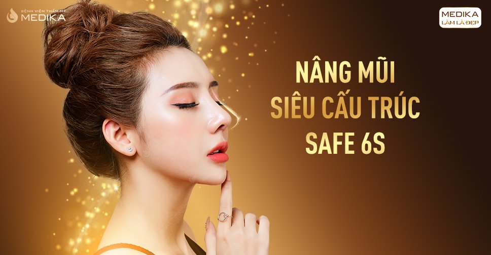 Mệt mỏi giá nâng mũi cấu trúc để thẩm mỹ mũi đẹp hoàn thiện Nang-mui-sieu-cau-truc-safe-6s