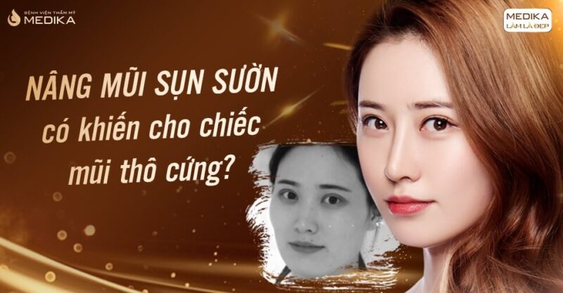 Nâng mũi sụn sườn có khiến cho chiếc mũi thô cứng? - Bệnh viện thẩm mỹ MEDIKA