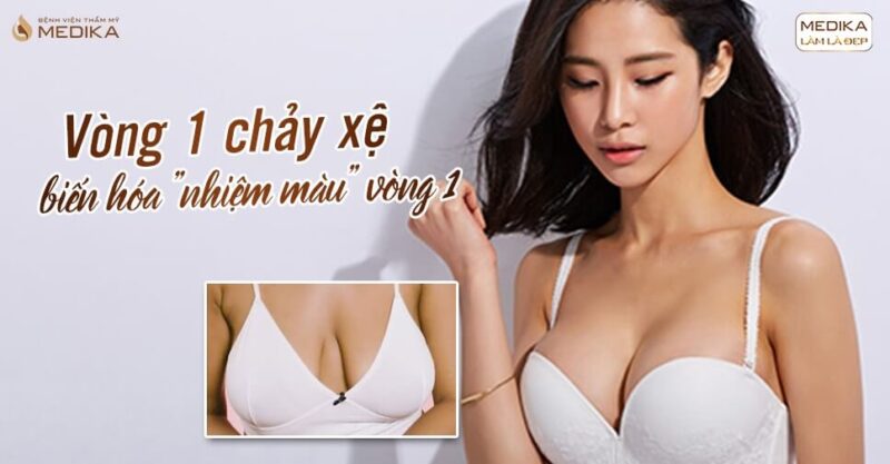 Nâng vòng 1 chảy xệ có an toàn khi phải loại bỏ mô lão hóa? - Bệnh viện thẩm mỹ MEDIKA