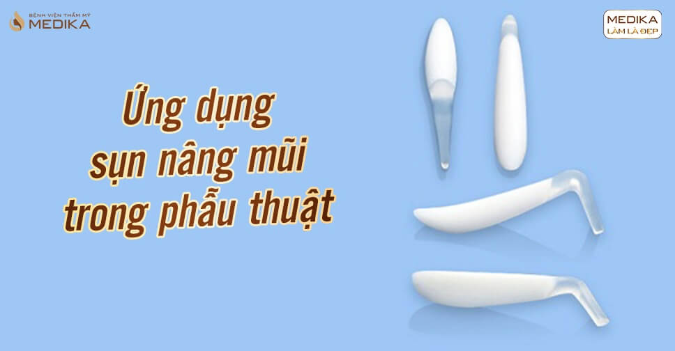 Ứng dụng sụn nâng mũi trong phẫu thuật nâng mũi đẹp - MEDIKA.vn