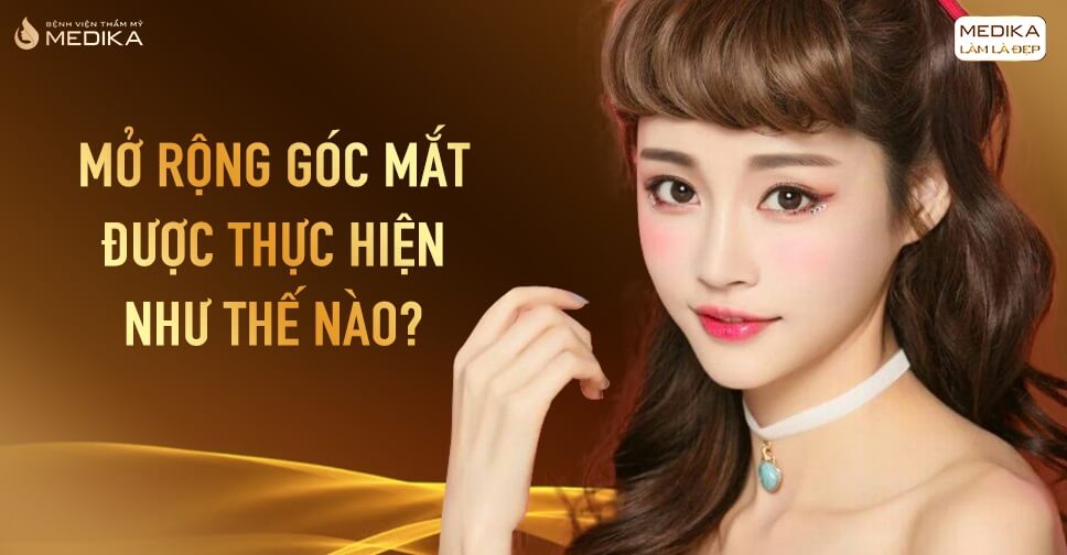 Mở rộng góc mắt được thực hiện như thế nào?